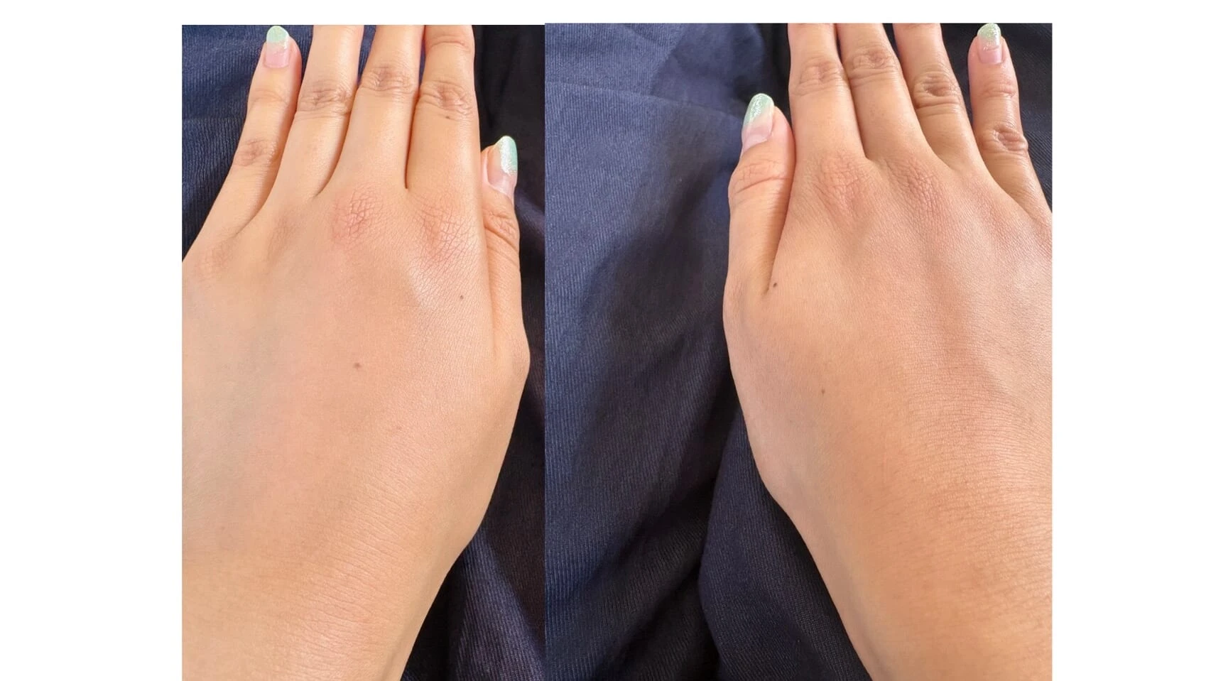 comparison