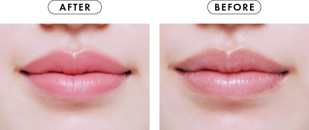 マットリップを上手に塗るテク江尾使ったBEFORE/AFTER