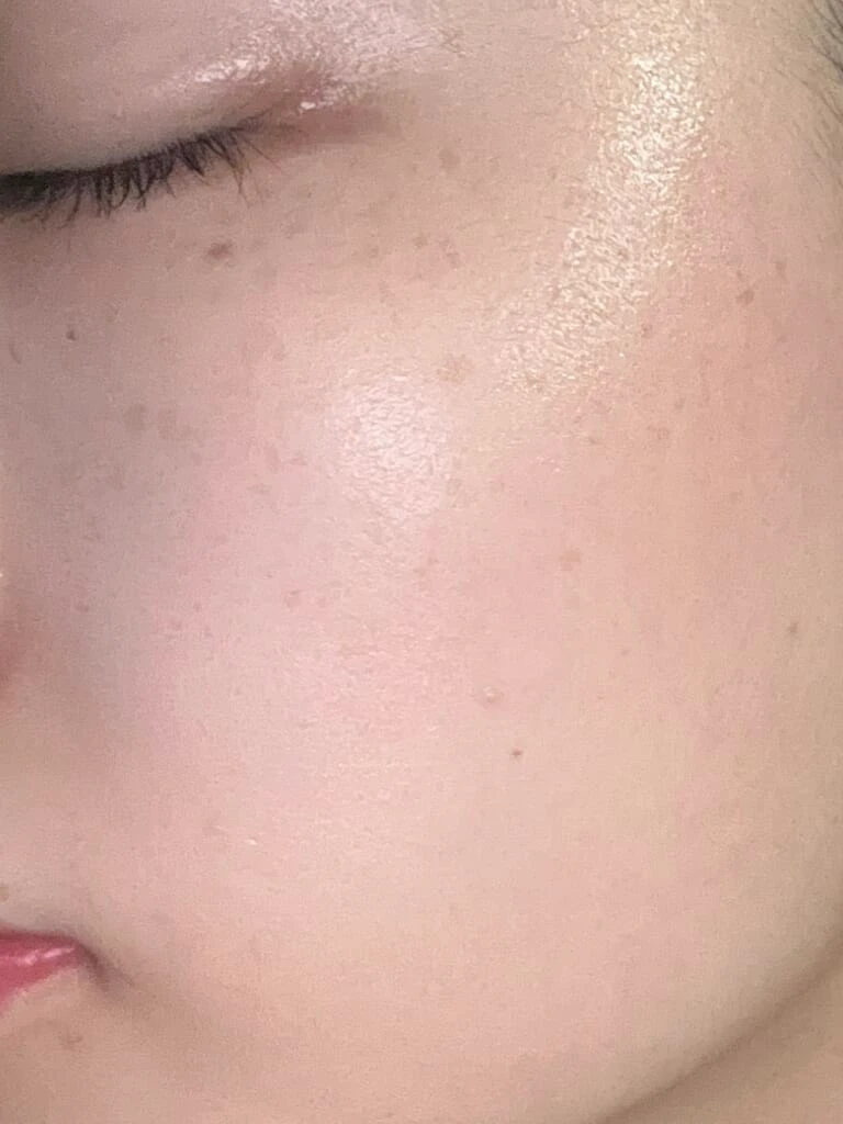 肌のトーンアップ
