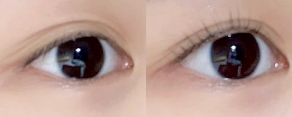 施術前後のビフォアフ