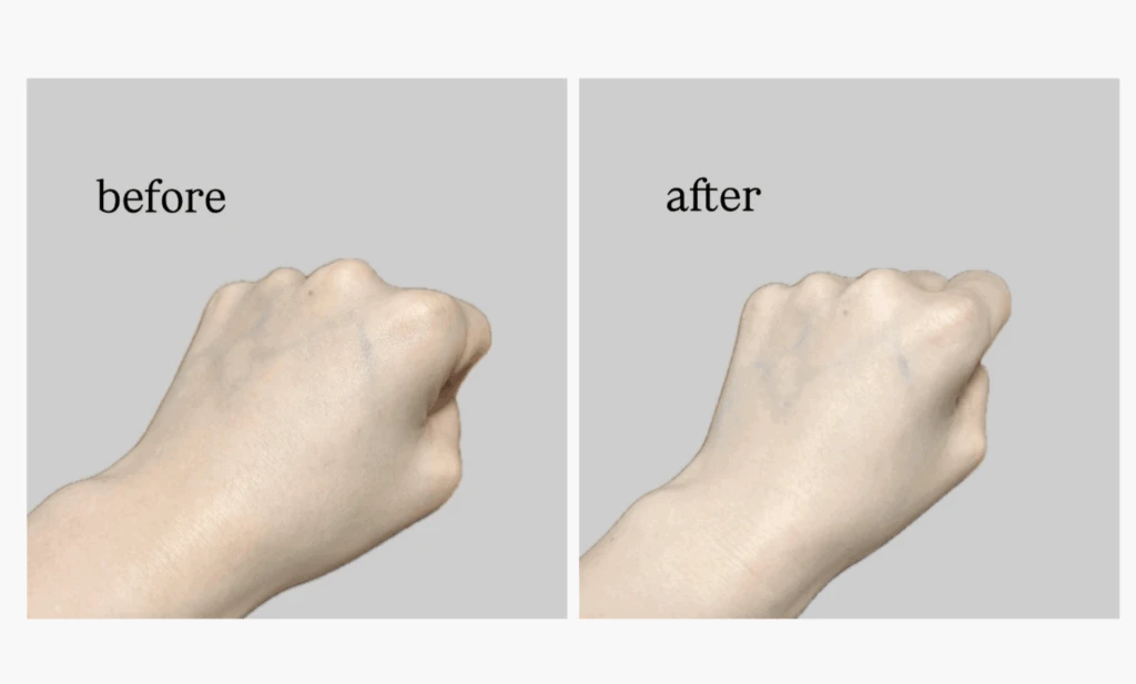 before＆after