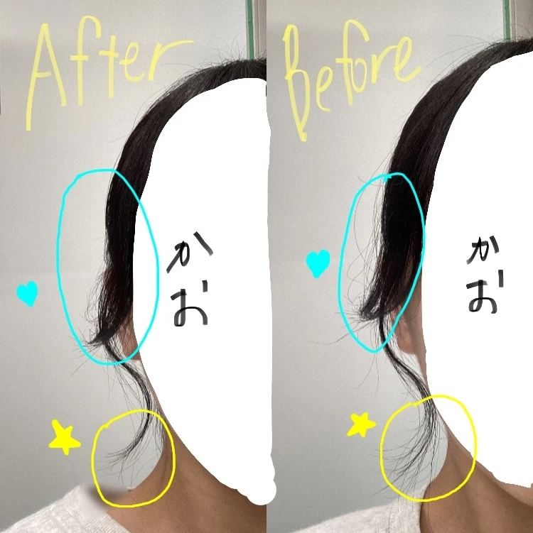 MieuMieu エスティック使用比較